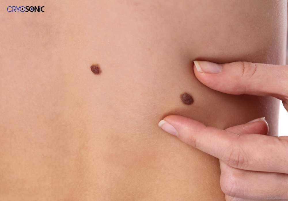 Infection Risk and Poor Aftercare Barnsley