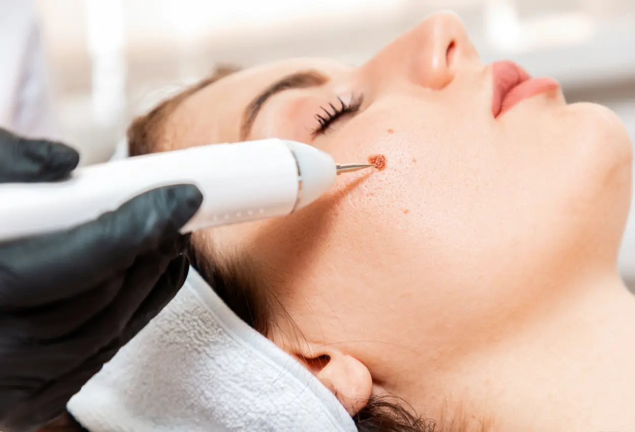 Frequently Asked Questions About Multiple Cryotherapy Treatments Barnsley