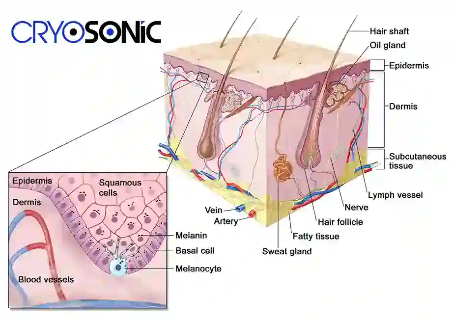 How Cryotherapy Stimulates Melanocyte Activity Barnsley